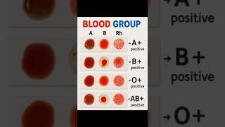 Blood Group Test Practical | A, B, AB, O Kaise Pata Kare? #shorts