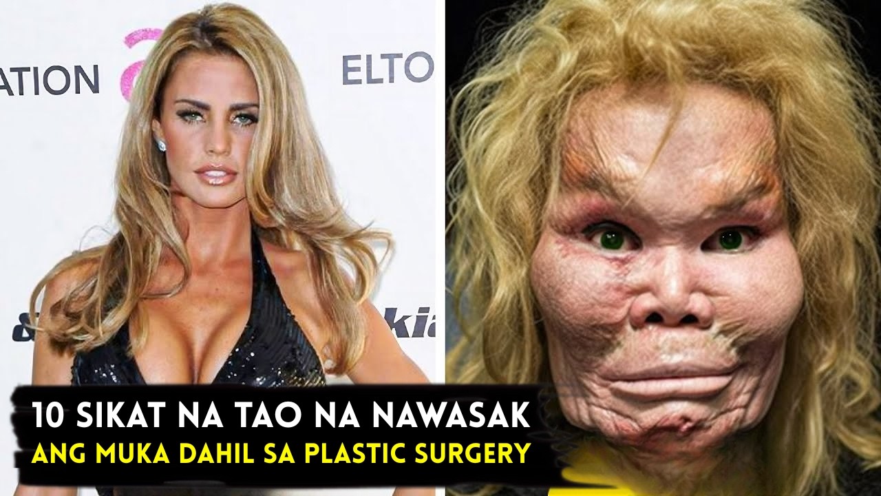 10 Sikat na Celebrity na Nawasak Ang Mukha Dahil sa Plastic Surgery | Part 2