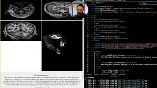 Enhancing the 3D Brain Viewer with AI: Fixing Mouse Scroll Issues & GitHub Copilot Magic