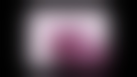 Dynamic Reconstruction of Deformable Soft-tissue with Stereo Scope in Minimal Invasive Surgery