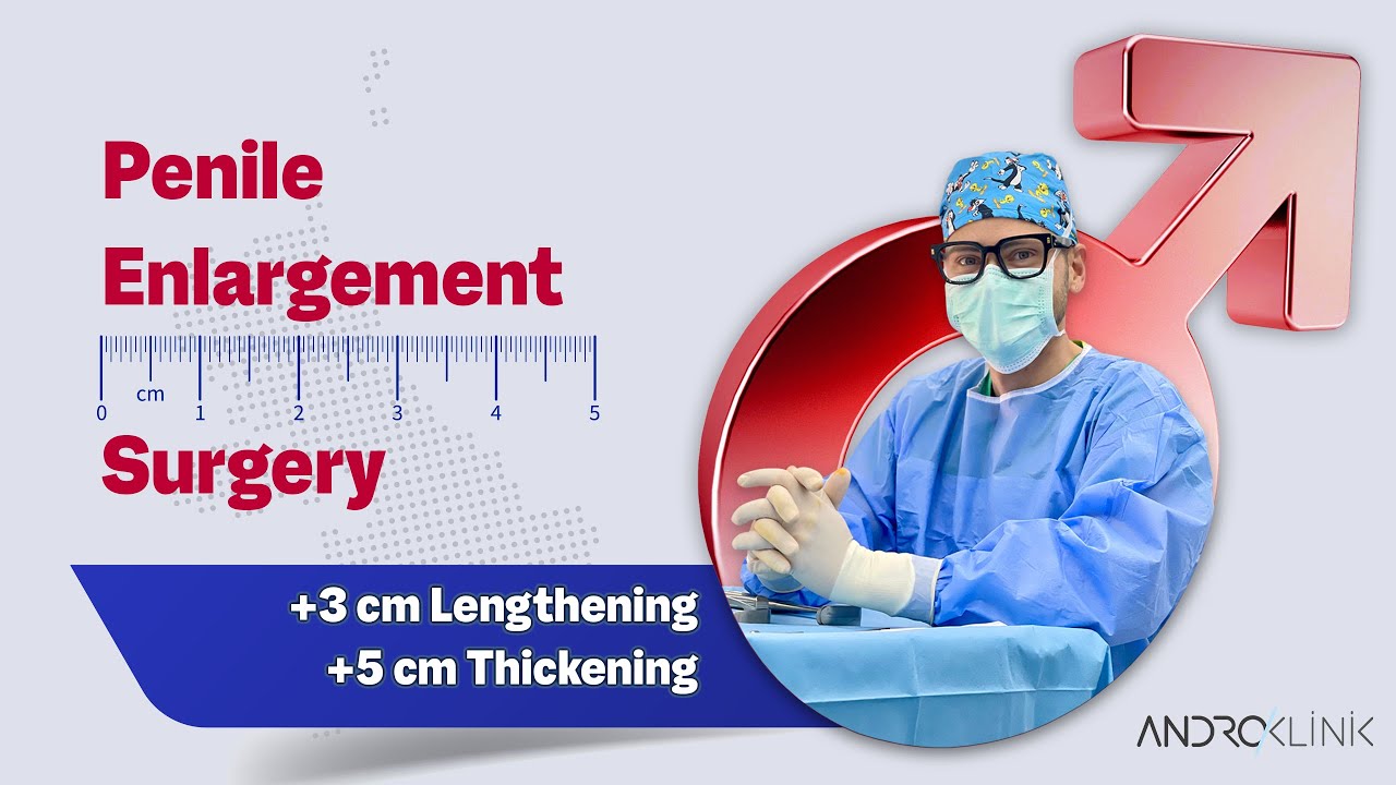 Penis Enlargement Surgery (+3 cm lengthening, +5 cm thickening) – Dr Evren ISIK