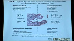 Molecular Therapeutic Strategies for Rheumatoid Arthritis