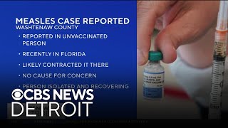 Measles case reported in Washtenaw County