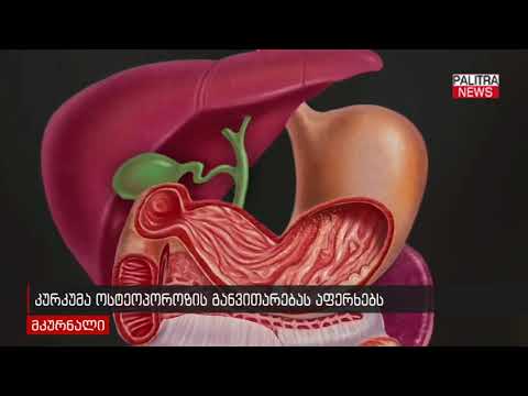 კურკუმა ოსტეოპოროზის განვითარებას აფერხებს