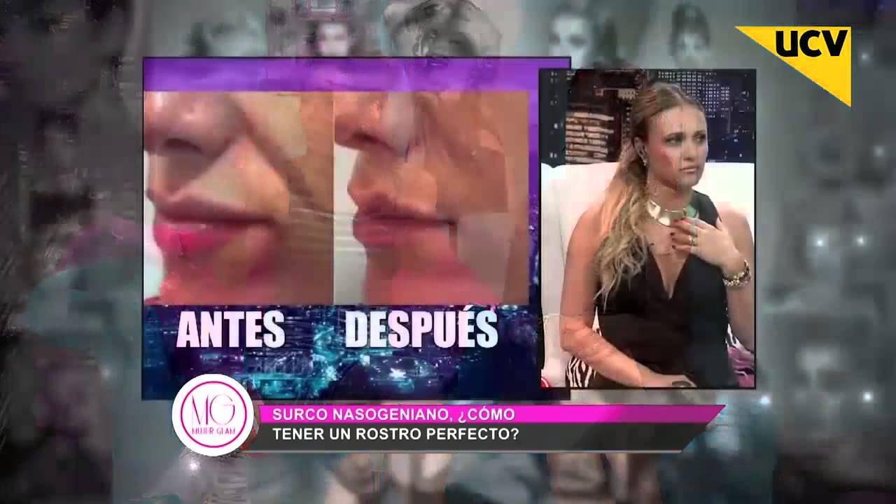 camera iphone 8 plus apk Dra Valdés. Eliminando el Surco Nasogeniano