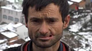 Eşek Sahibinin Yanağını Parçaladı