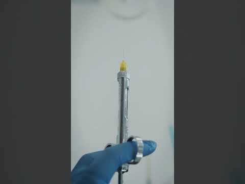 كيفية علاج تورم الشفاه بعد البنج