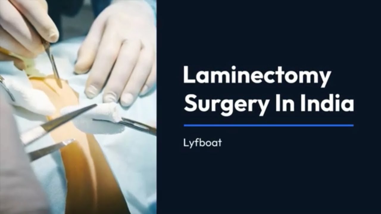 Laminectomy Surgery Cost in India Laminectomy Surgery in India YouTube