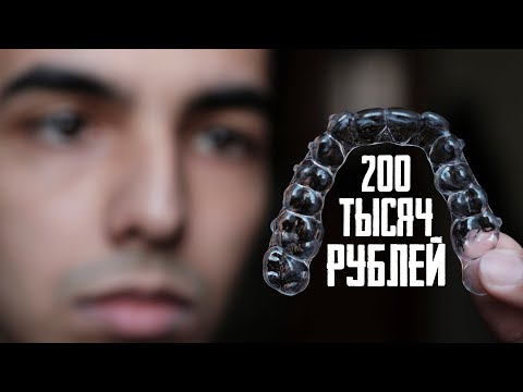 Подводные камни ЭЛАЙНЕРОВ