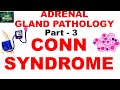 Adrenal Gland Pathology: Part -3. HYPERALDOSTERONISM. CONN  SYNDROME