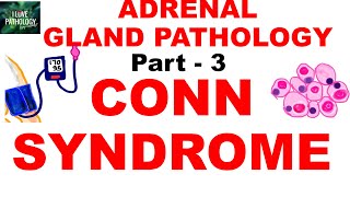 Adrenal Gland Pathology: Part -3. HYPERALDOSTERONISM. CONN  SYNDROME