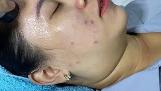 Massage Mặt / Relax With Hana Spa & Clicnic / Chăm sóc da mặt cho khách