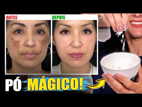 Use esse PÓ para Clarear Manchas de Pele, inclusive Melasma
