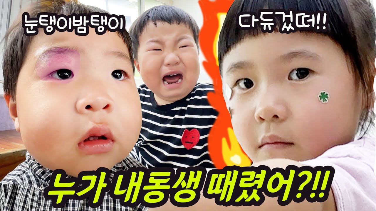 어린이집에서 친구한데 맞고 왔어요 ㅠㅠ 어떻게 해야할까요?