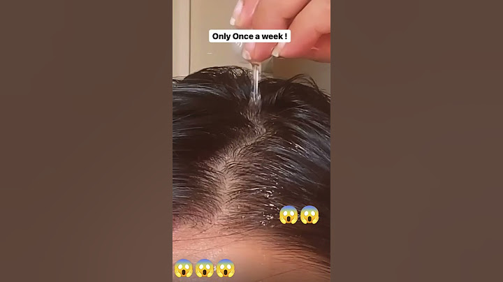 How to use  vitamin E capsule for coconut oil !! Hair Growth! Hair fall l rough  & frizzy hair