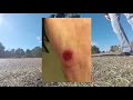 End of video