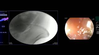 Sigmoid Leakage