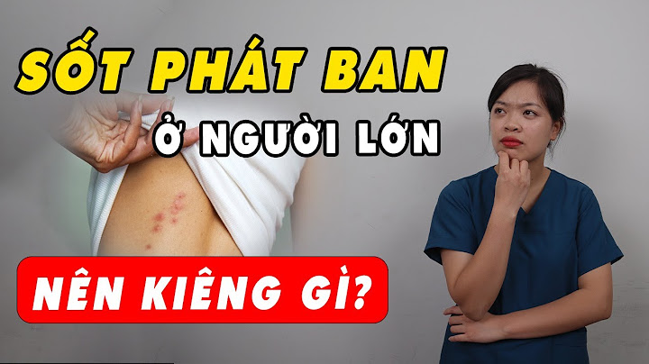 Làm thế nào để nhanh hết sốt phát ban năm 2024