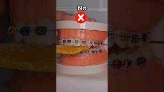 Freeze Dried Mango with Braces?! #kidsvideo #viral #youtubeshorts #trending #youtube #funny #tiktok