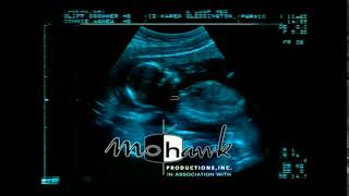 Fortis, Mohawk, And Wbtv In G Major 277