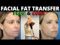 The Pros and Cons of Facial Fat Transfer from Facial Plastic Surgeon Dr. Amir Karam