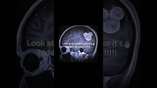 Look at my brain tumor, it's a hidden Mickey!