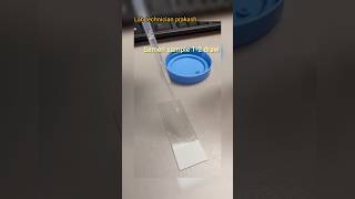 sperm count #pathology #bmlt #dmlt #hospital #labtechnologist #shorts #sperm #spermcount #youtube