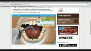 Braces surgery game screenshot 3