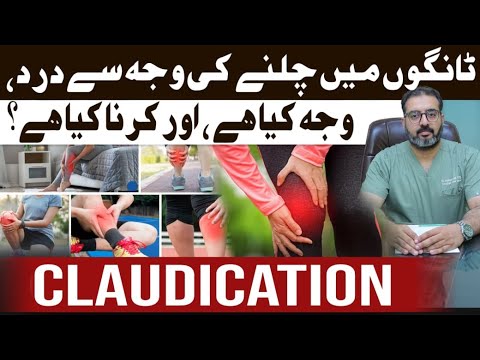 Claudication Rash Claudication Explained - Why Your Legs Hurt While Walking & What You ...