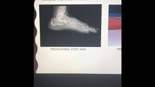 Foot Projections And Positioning By Gianna