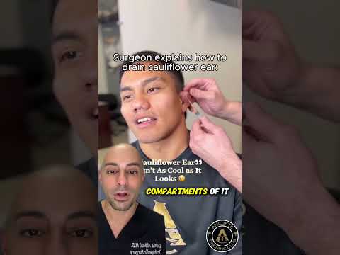 Stop Draining Your Cauliflower Ear Like This...