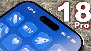 iPhone 18 Pro Max - The Major Change We Wanted!