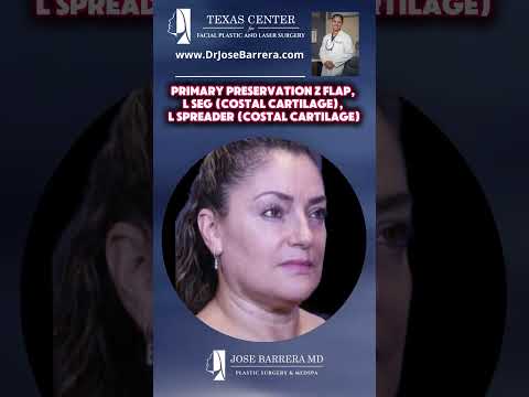 Video thumbnail: ✨ Precision & Preservation! ✨ #PreservationRhinoplasty · Dr. Jose Barrera