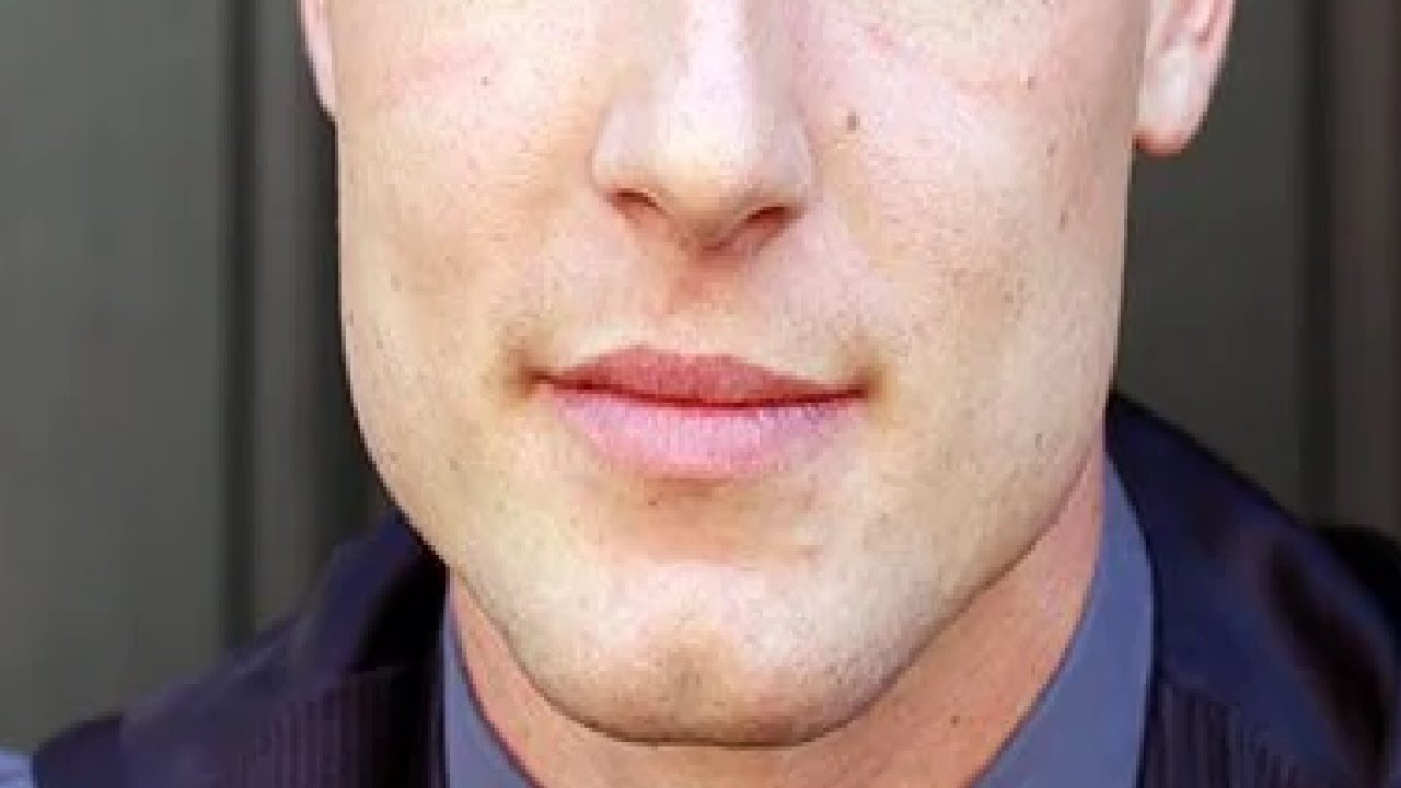 how to get rid of loose skin on neck after weight loss YouTube