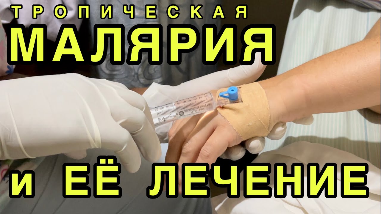 Тропическая малярия. Как лечат малярию в Гане. - YouTube