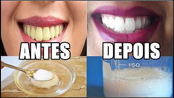Como deixar seu dente branco caseiro?