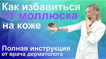 Моллюск контагиозный это/Лечение моллюска на коже у детей и взрослых