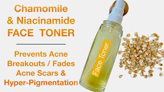 How To Make Chamomile & Niacinamide Facial Toner For Acne Free Face & To Clear Dark Spots
