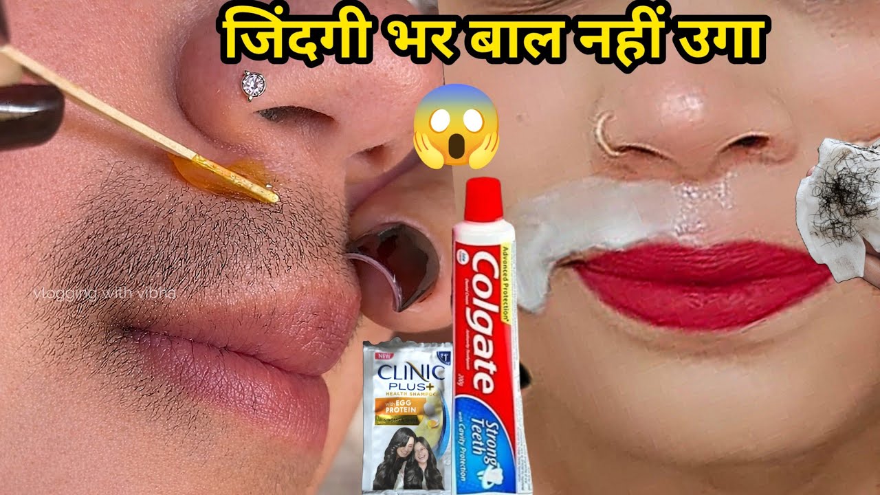 डॉक्टर ने बताया Vaseline से बिना दर्द चेहरे के बाल निकालने का आसान तरीका😱|| Facial Hair Removal