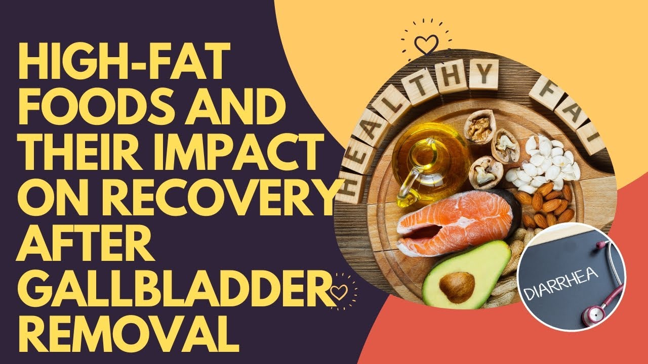 High-Fat Foods And Their Impact On Recovery After Gallbladder Removal