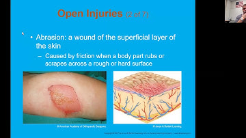Ch 26 Soft Tissue Injuries