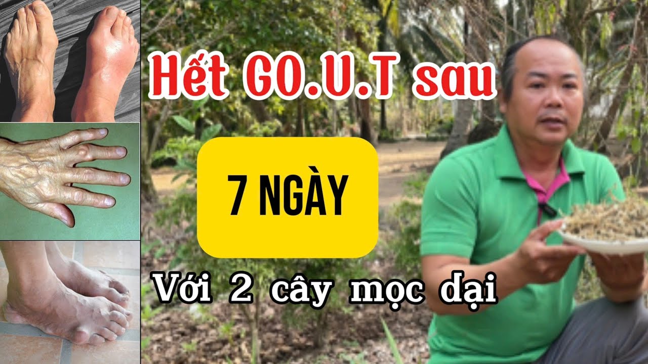 Hết G.o.ut, với 2 cây Mộc Dại, ở đâu cũng có