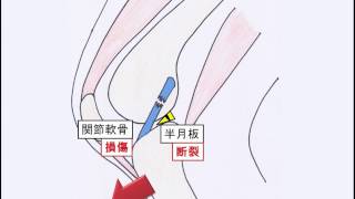 膝靭帯手術のすべて メジカルビュー社｜整形外科｜膝靱帯手術のすべて
