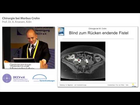 Video: Komplikationen Bei Morbus Crohn: Fisteln Und Mehr