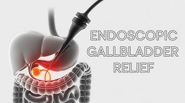 Drainage of the Gallbladder in High-Risk Patients with Acute Cholecystitis: Complete Guide