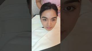 Mole Removal Journey Part 1  Bagay Kaya Sakin Walang Nunal moleremoval tiisganda moleremove