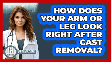 How Does Your Arm Or Leg Look Right After Cast Removal? - Orthopedic Support Network