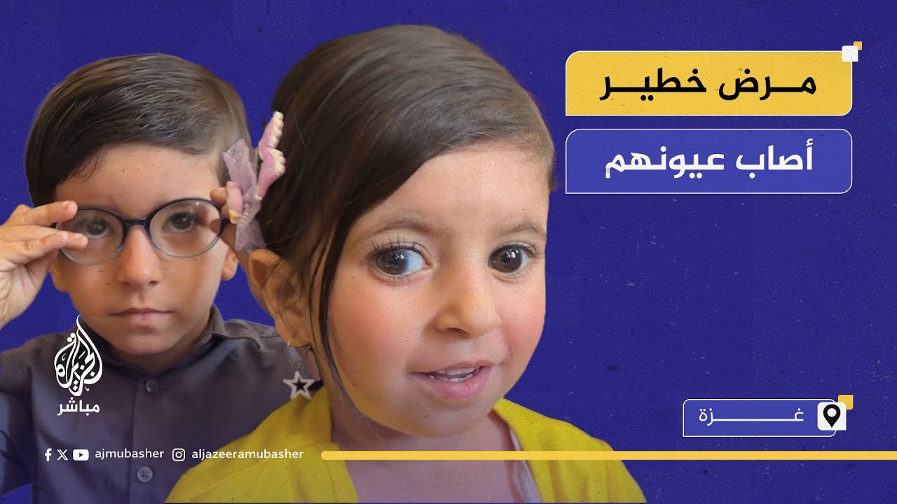 أطفال من غزة مهددون بفقدان الرؤية بسبب "سارق البصر"!