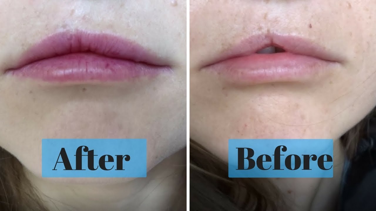 Scar Filler Makeup Uk Mugeek Vidalondon