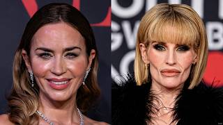 Celebrities Who Don't Look Like Themselves Anymore (3 Hour Marathon)
